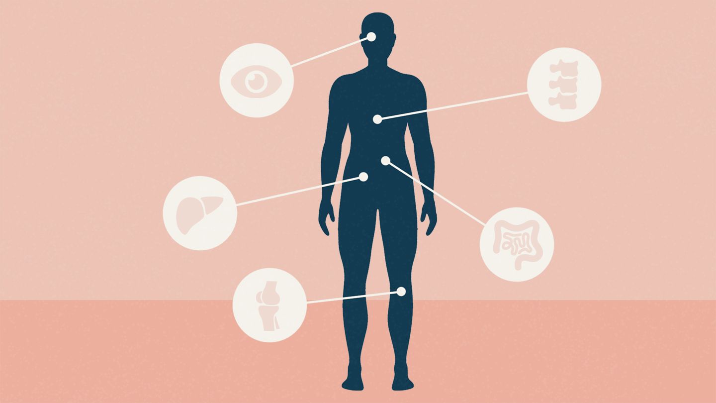 illustration of body and different organs