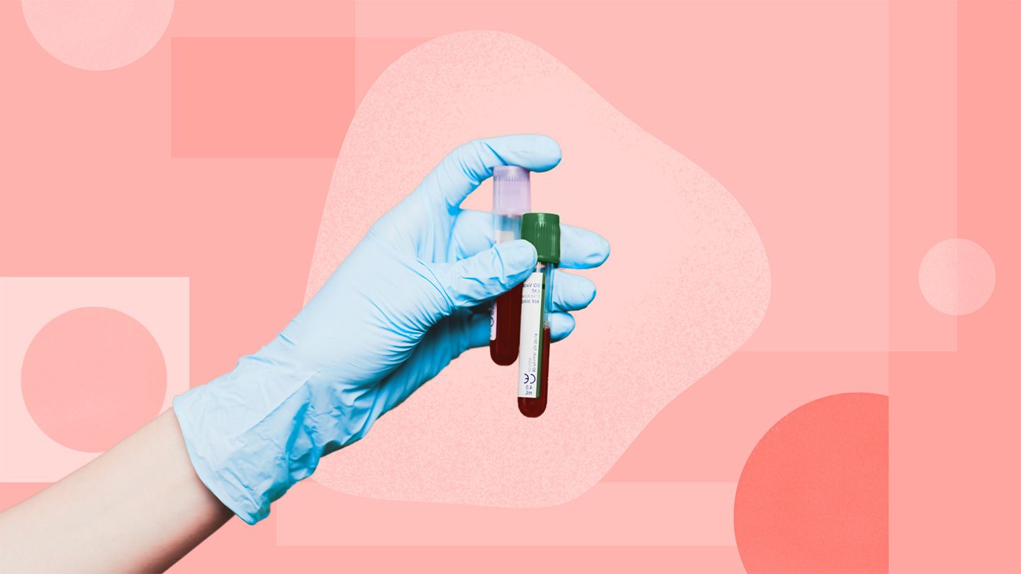 hand with medical glove holding blood test vials