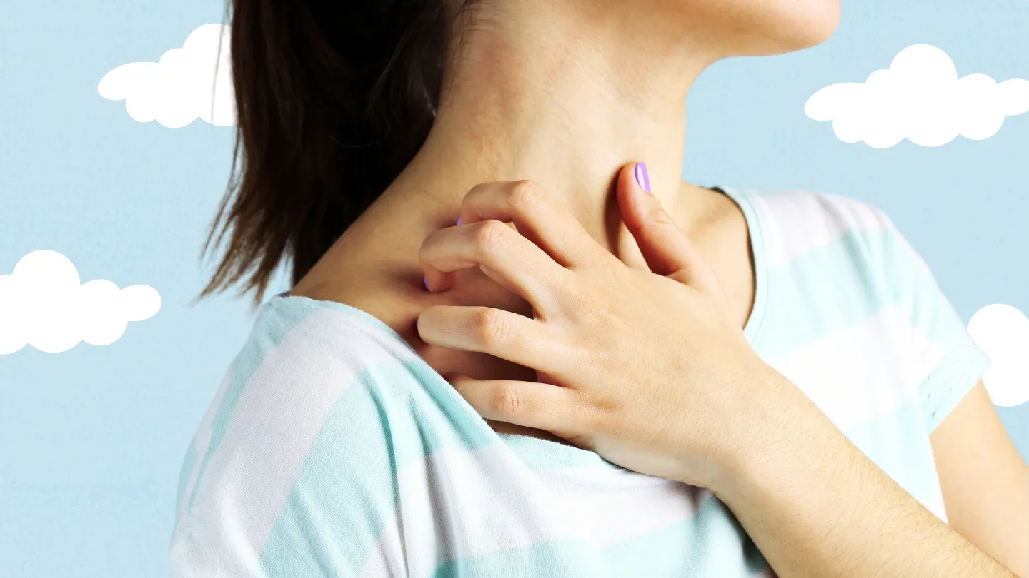 woman sratching rash on her neck blue sky background
