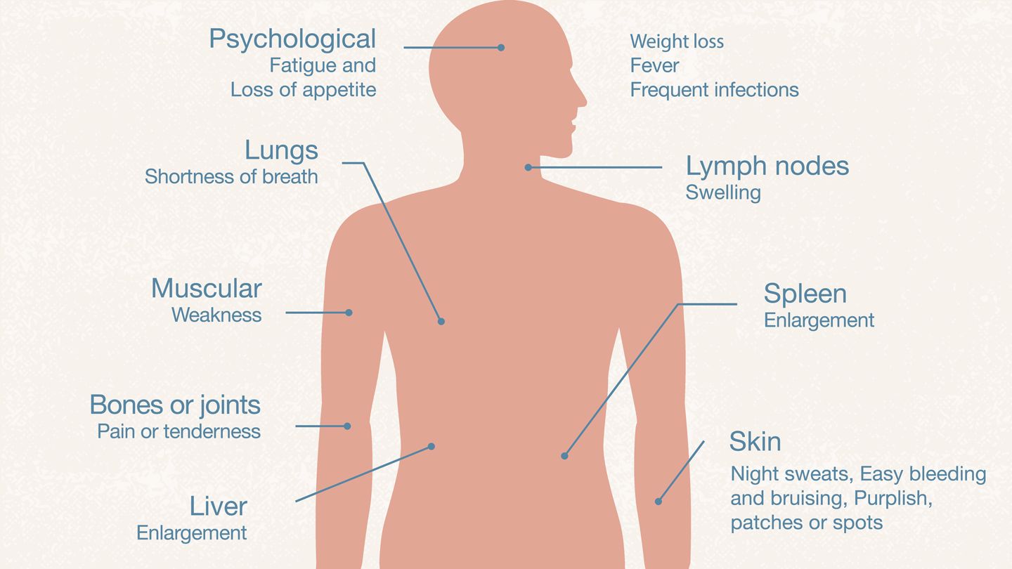 What-Are-Common-Symptoms-of-Leukemia