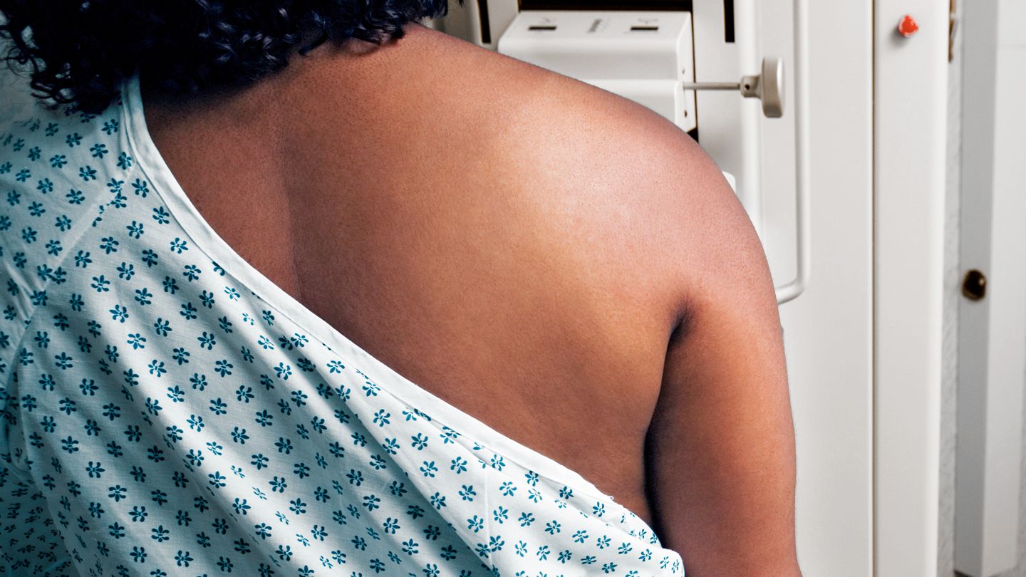 Black woman rear view getting a mammogram