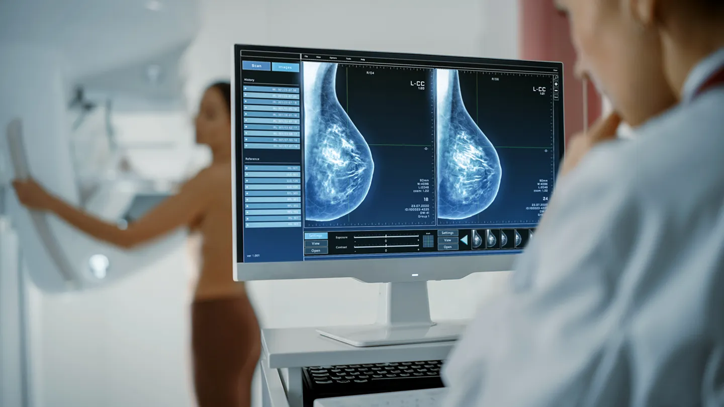 woman getting mammogram technician looking at breast scans