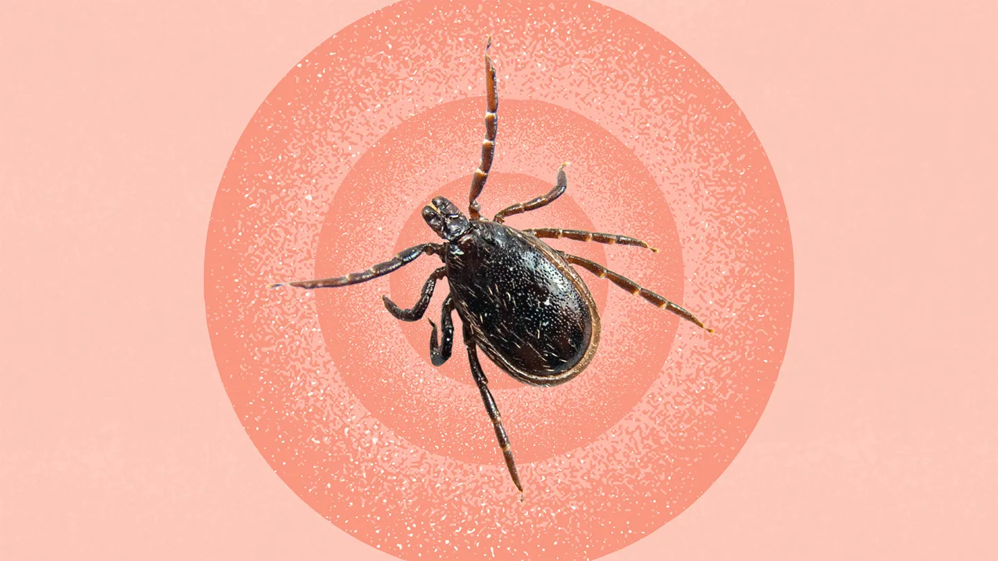 What-Is-Babesiosis bite swelling symptoms