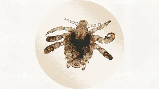 Pubic Lice: Symptoms, Diagnosis, and Treatment