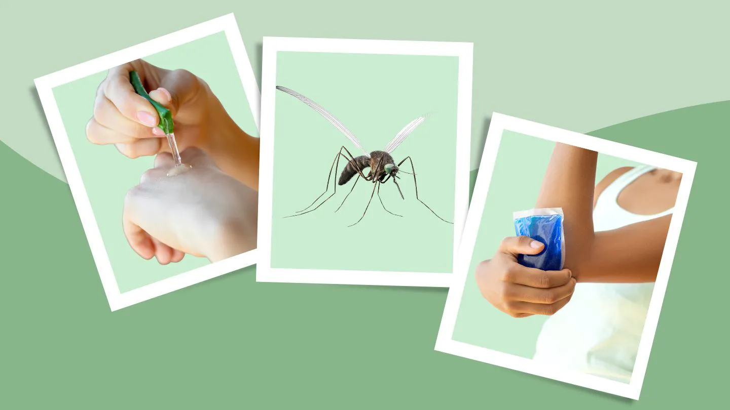 Mosquito bite and remedies